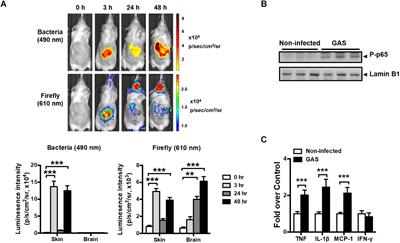 Group A Streptococcus Subcutaneous Infection-Induced Central Nervous System Inflammation Is Attenuated by Blocking Peripheral TNF